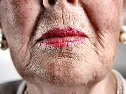 RevContent Ad Example 46288 - Gran Stuns Doctors: Removes Her Wrinkles With This Simple Tip (Try Tonight)