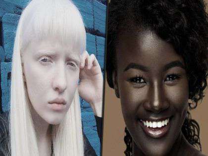 RevContent Ad Example 30616 - Beautiful People With Unique Skin Colors In The World