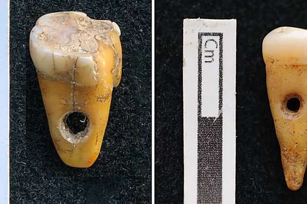 Outbrain Ad Example 48092 - Rare 8,500-year-old Human Teeth Used As Jewelry Discovered In Turkey