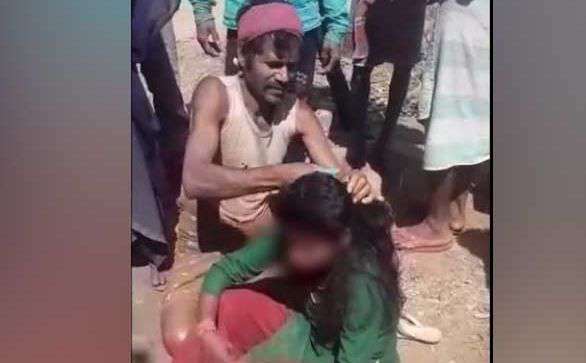 Taboola Ad Example 34821 - Minor Girl In MP Thrashed, Braid Chopped Off In Public For Allegedly Talking To A Boy