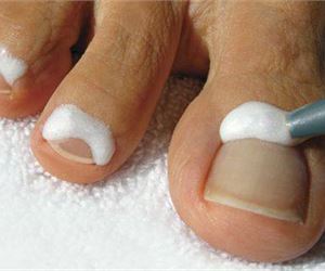 Content.Ad Ad Example 10337 - This Woman Cured Her Nail Fungus In 10 Minutes, Watch How