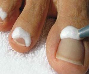 Content.Ad Ad Example 3952 - Inspiring: This Woman Cured Her Toe Nails Fungus In 10 Min.