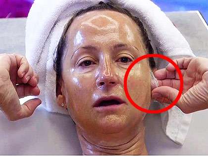 RevContent Ad Example 54046 - Australian Wrinkle Remedy Stuns TV Judges: Forget Surgery, Do This Once Daily