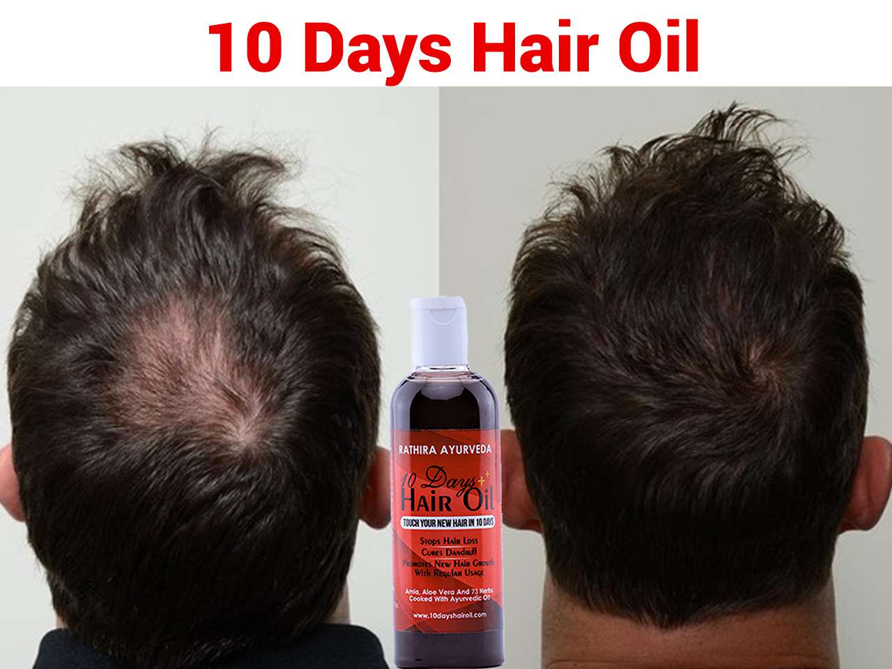 Taboola Ad Example 39577 - Going Bald? This ’10 Days’ Ayurvedic Hair Oil From Kerala Can Help You !