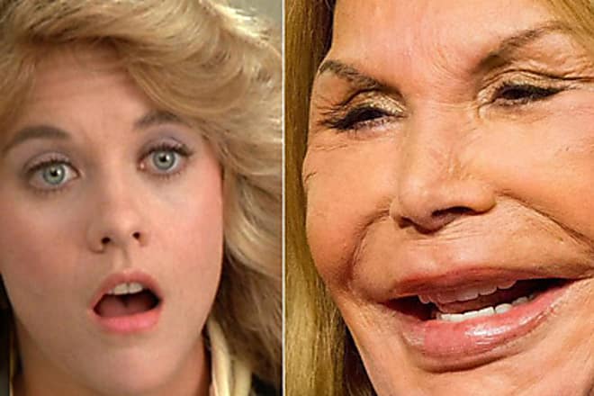 Taboola Ad Example 6326 - 12 Celebs Who Are Unrecognizable After Plastic Surgery
