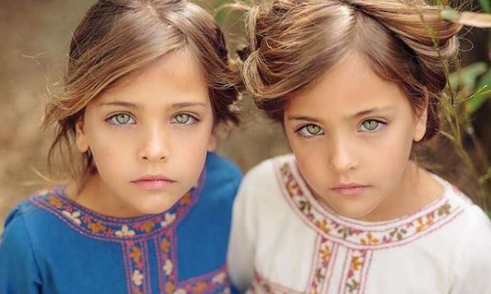 Taboola Ad Example 61157 - These Twins Were Named "Most Beautiful In The World," Wait Till You See Them Today