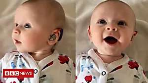 Outbrain Ad Example 46699 - Moment Baby Girl's New Hearing Aids Are Turned On