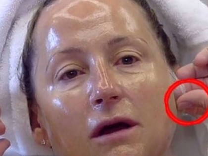 RevContent Ad Example 7094 - Granny Shocked Doctors By Removing 20 Years Off Her Face With This $4 Trick
