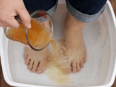 RevContent Ad Example 44934 - If You Have Toenail Fungus, Do This Immediately (Genius!)