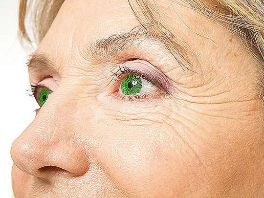 RevContent Ad Example 46287 - Dermatologists Stunned By Gran's Easy Wrinkle Removal Tip