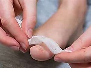 Outbrain Ad Example 35567 - Simple Way To Reduce Toenail Fungus? (Watch)