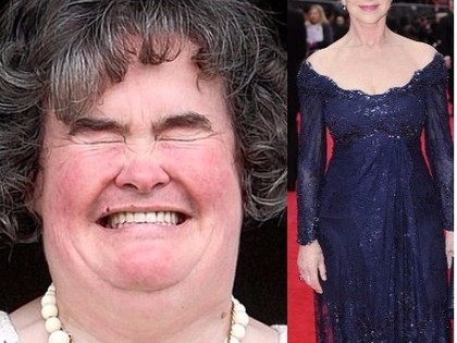RevContent Ad Example 6917 - Susan Boyle Is So Skinny Now And Looks Gorgeous!