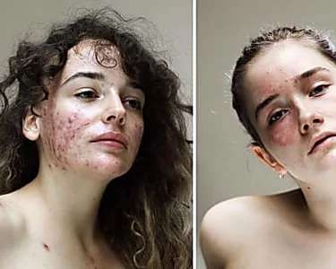 Outbrain Ad Example 30586 - Sin Filtros Ni Maquillaje: Esta Fotógrafa Captura La Belleza De Las Mujeres 'reales'