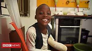 Outbrain Ad Example 44708 - Making Prosthetic Limbs For Nigerian Children