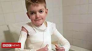 Outbrain Ad Example 40925 - Boy Whose Skin Is Peeling Sent 18,000 Cards