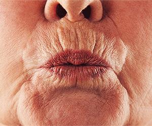 Content.Ad Ad Example 20400 - Don't Do Botox - This Removes Lip Lines & Jowls In Seconds!