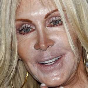 Zergnet Ad Example 49049 - Plastic Surgeries That Left Celebrities Jobless In Hollywood