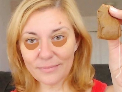 RevContent Ad Example 5060 - London Mum Reveals Eyebag Remedy: Forget Surgery, Do This Once Daily Instead