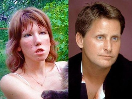 RevContent Ad Example 5679 - 30 Sexy Celebrities Who Got Married To Ugly Spouses!