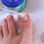 Content.Ad Ad Example 30543 - Doctor: This Breakthrough "Ends" Toenail Fungus (Watch)