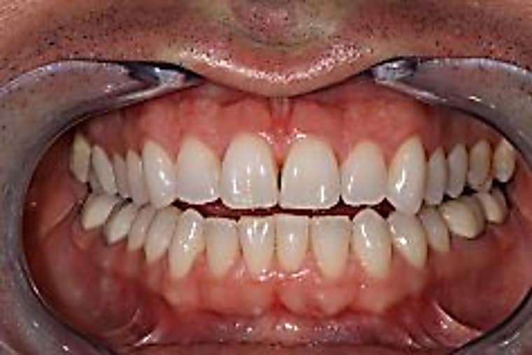 Taboola Ad Example 9985 - Dental Implants | Sponsored Links