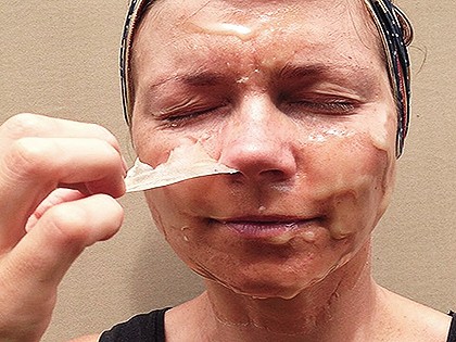 RevContent Ad Example 4518 - London Mum Reveals Wrinkle Remedy: Forget Surgery, Do This Once Daily Instead