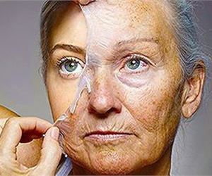 Content.Ad Ad Example 5345 - 74 Year Old Grandma Shocks Doctors: Forget Botox, Do This