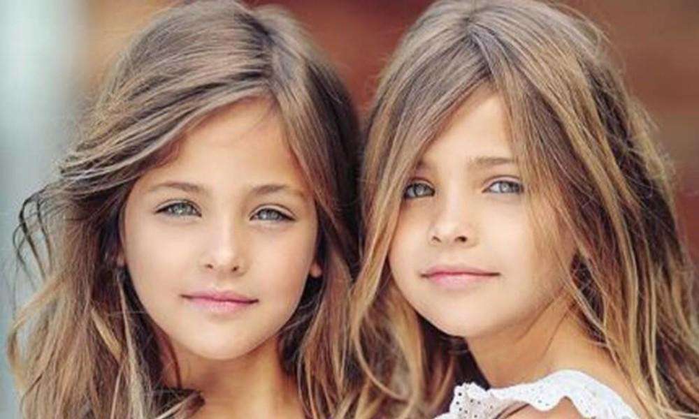 Taboola Ad Example 54139 - These Twins Were Named "Most Beautiful In The World," Wait Till You See Them Today