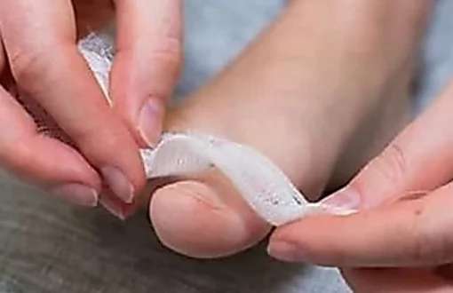 Outbrain Ad Example 35610 - Simple Way To Reduce Toenail Fungus? (Watch)