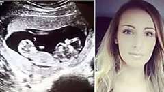 Outbrain Ad Example 44541 - [Photos] Woman's Pregnant Belly Started Growing Too Big, Doctor Found Something Strange In Ultrasound