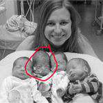 Content.Ad Ad Example 38978 - Mom Gives Birth To Quadruplets. Doctors Notices A Baby