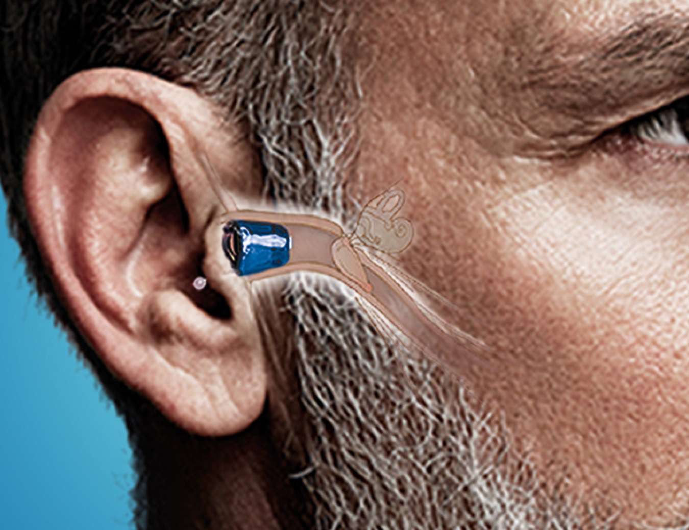 Taboola Ad Example 53499 - Wanted: Canadians Over 50 To Try Out Hearing Aid For Free!