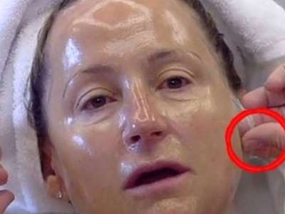 RevContent Ad Example 62814 - Top Doctor: The Skin Tightening Technique Every Woman Over 45 Should Know
