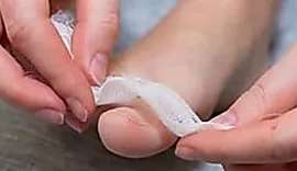 Outbrain Ad Example 35527 - Simple Way To Reduce Toenail Fungus? (Watch)