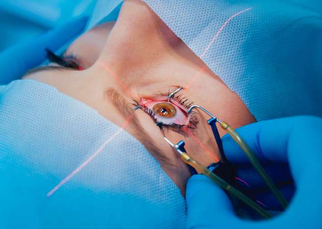 RevContent Ad Example 44757 - Lasik Surgery Could Be Cheaper Than You Think