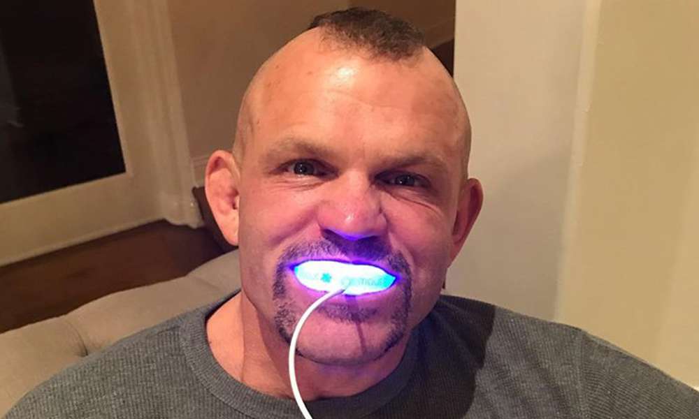 Taboola Ad Example 65690 - Celebrities Swear By New At-Home Teeth Whitening Solution
