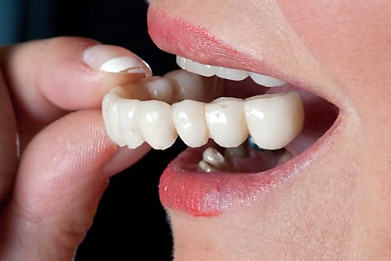 Taboola Ad Example 19588 - Dental Implant Centers | Sponsored Ads