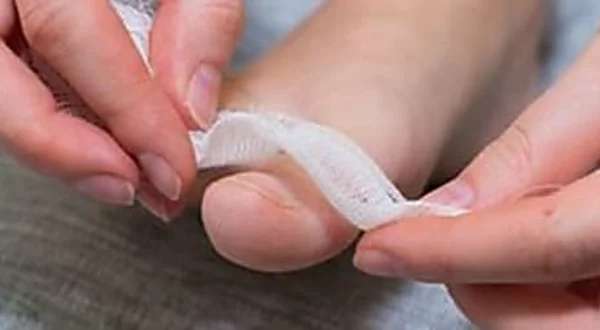 Outbrain Ad Example 30571 - Simple Way To Reduce Toenail Fungus? (Watch)