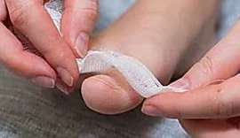 Outbrain Ad Example 30195 - Simple Way To Reduce Toenail Fungus? (Watch)