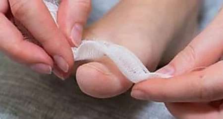Outbrain Ad Example 30328 - Simple Way To Reduce Toenail Fungus? (Watch)