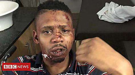 Outbrain Ad Example 65208 - Good Samaritan TV Host 'beaten By Racists'