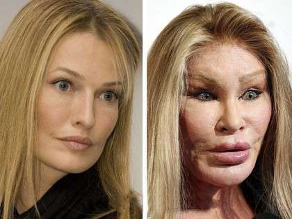 RevContent Ad Example 55273 - 17 Celebrities Before And After Plastic Surgery