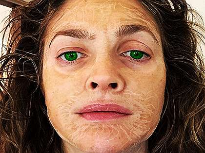 RevContent Ad Example 46298 - 1 Brilliant Tip Reverses Years Of Aging (Dermatologists Speechless)