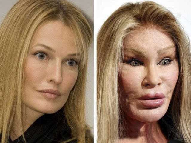 RevContent Ad Example 56393 - Unrecognizable! 15 Stars Before And After Plastic Surgery