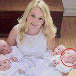 Content.Ad Ad Example 38973 - Mom Gives Birth To Quadruplets. Doctors Notices Her Baby