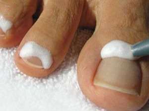 RevContent Ad Example 40155 - Do This To "End" Toenail Fungus (Try Today)
