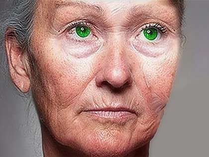 RevContent Ad Example 32094 - Doctors Stunned By 72-year-old Grandma's Discovery. Forget Surgery (Do This)