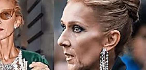 Outbrain Ad Example 39155 - [Pics] Celine Dion Takes Off Makeup, Leaves Us With No Words