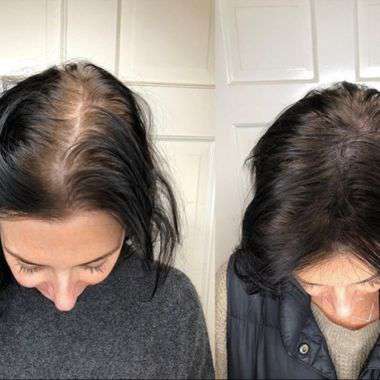 Yahoo Gemini Ad Example 55637 - Thin Hair? This New Shampoo Could Be The Answer