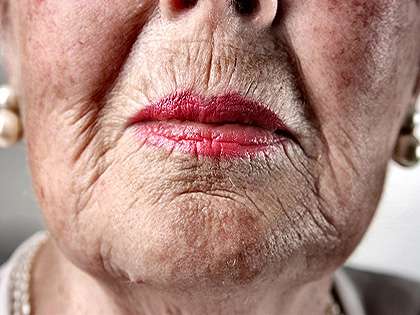 RevContent Ad Example 57534 - Doctors Stunned: Grandma Removes Her Wrinkles With This $4 Tip